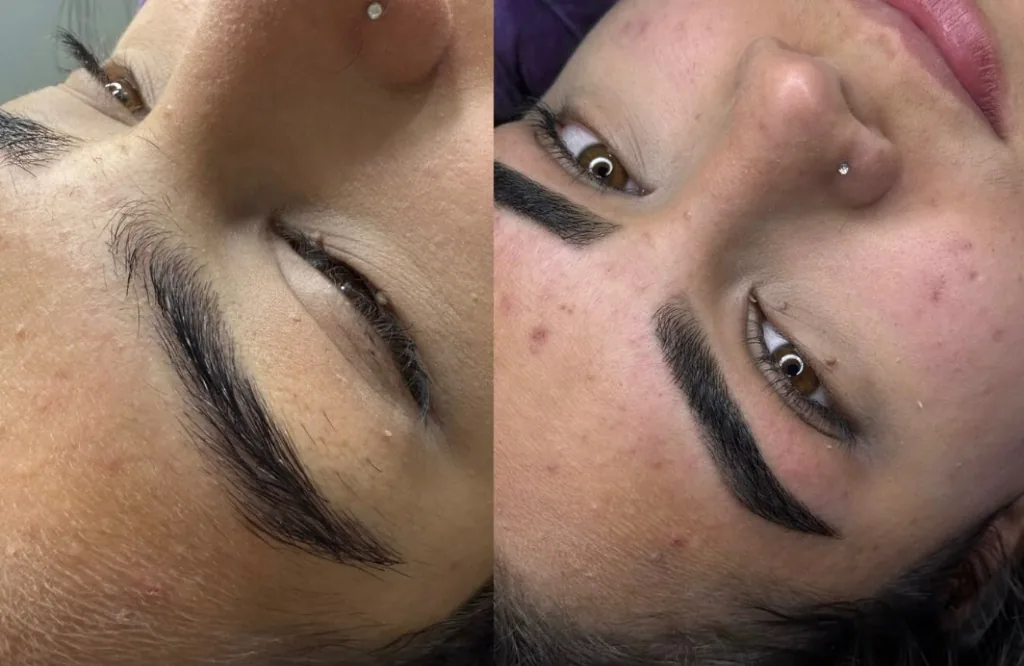 Antes e Depois design e definição com simetria perfeita