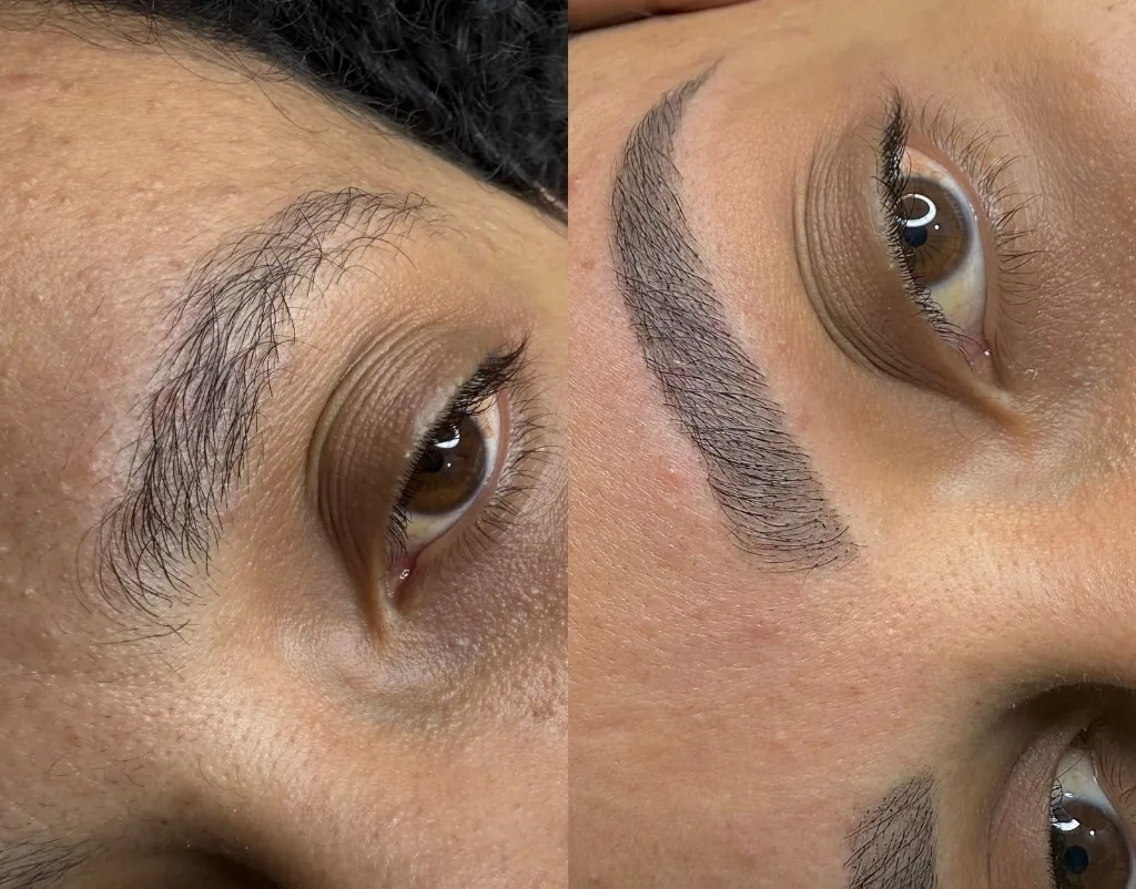 Antes e Depois de Micropigmentação Fio a Fio com efeito natural