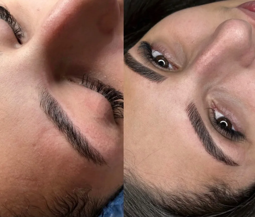 Antes e Depois com alinhamento e densidade sob medida